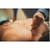 acupuntura para dor no ombro marcar Ilha dos Ayres