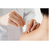 acupuntura para dor no ombro Glória